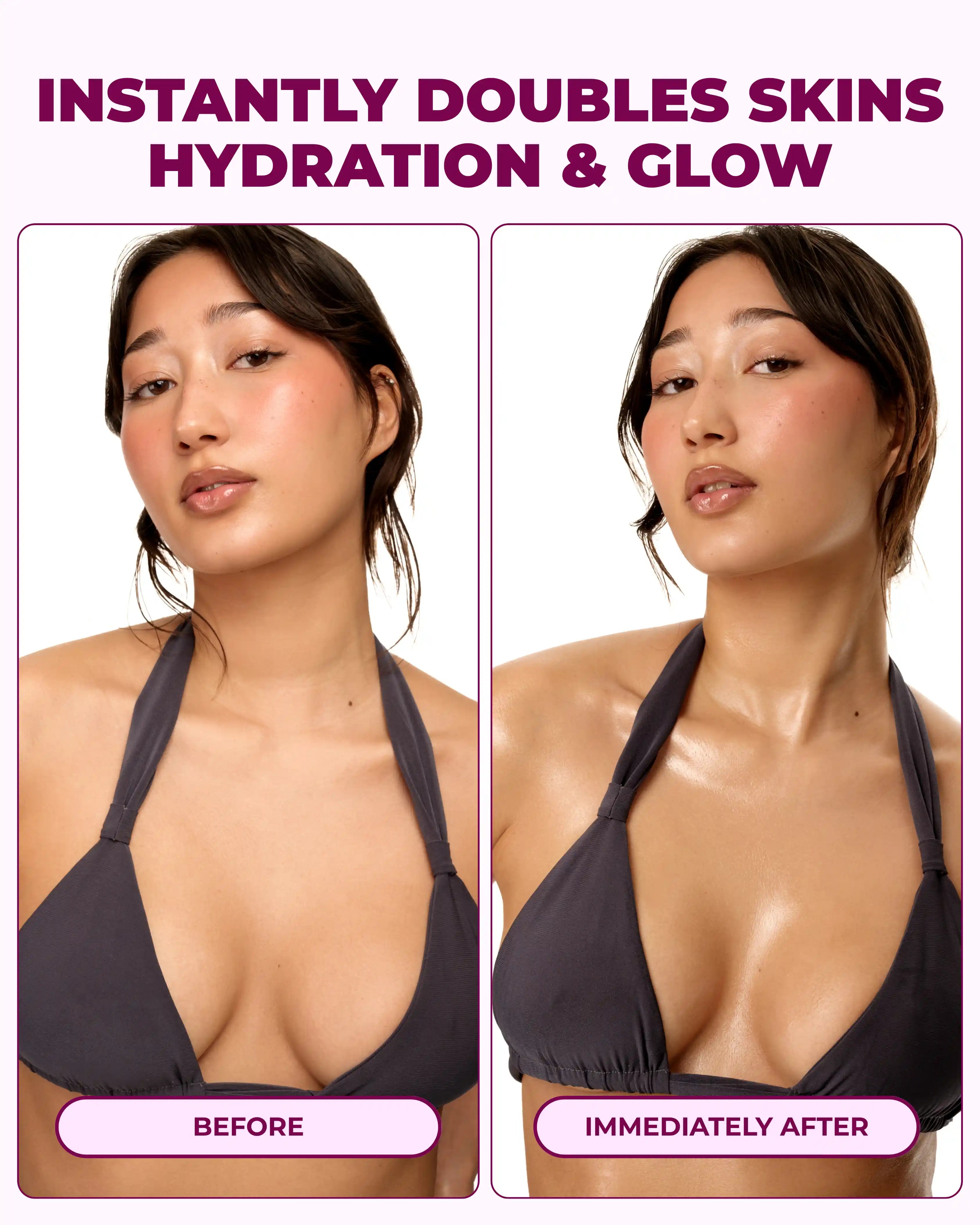 Body Acne Bundle