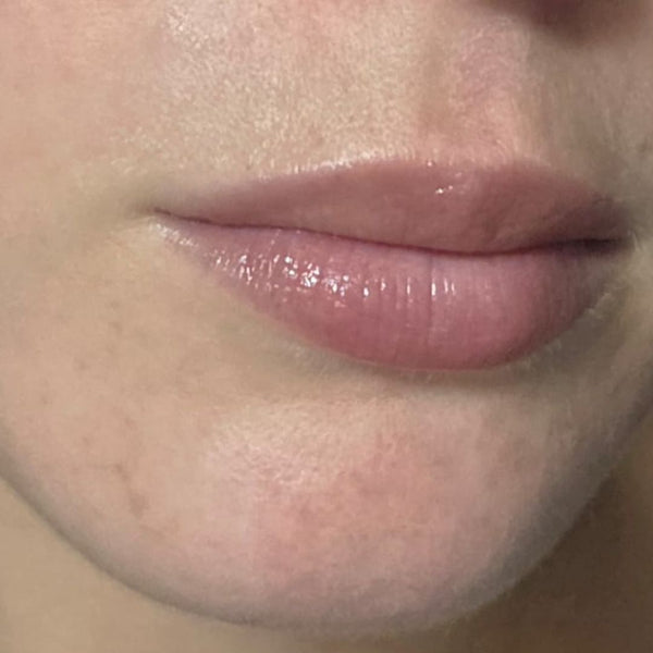 AFTER 2 WEEKS