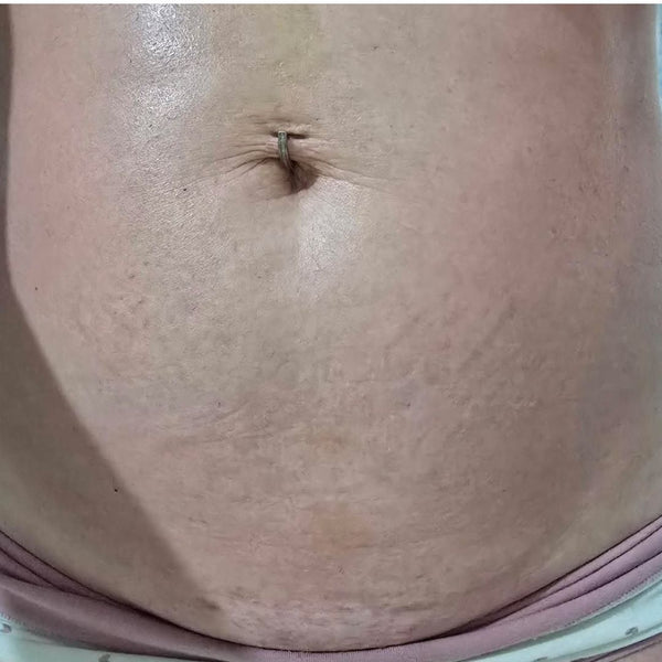 AFTER 3 MONTHS