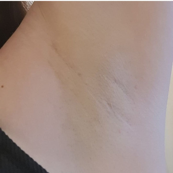 AFTER 2 WEEKS