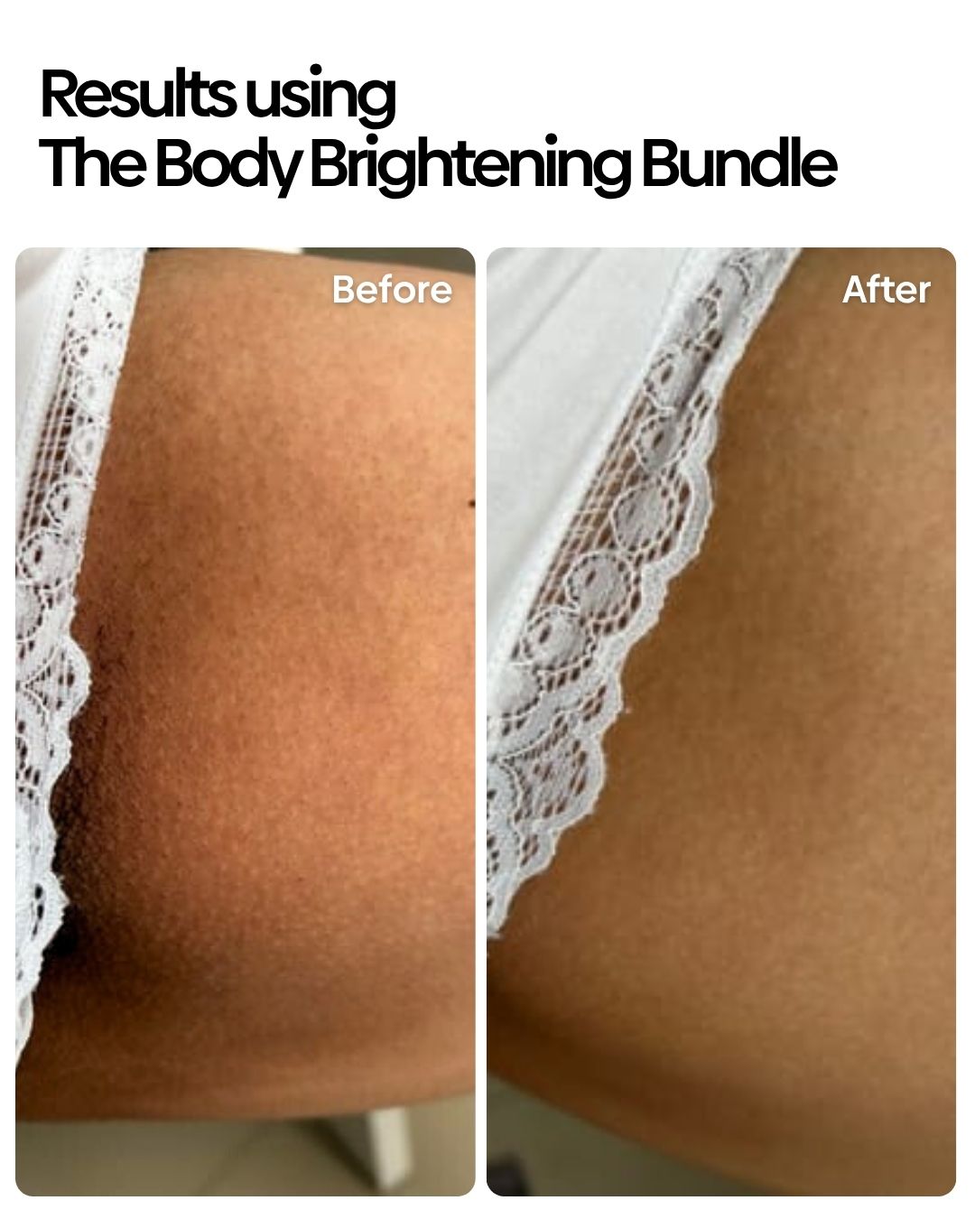 Body Brightening Bundle