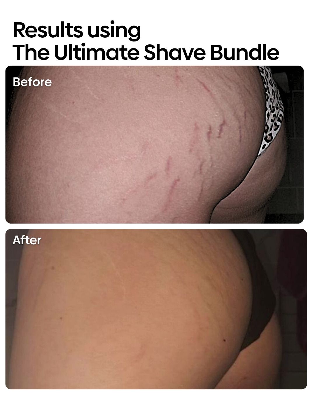 Stretchies Bestie Bundle