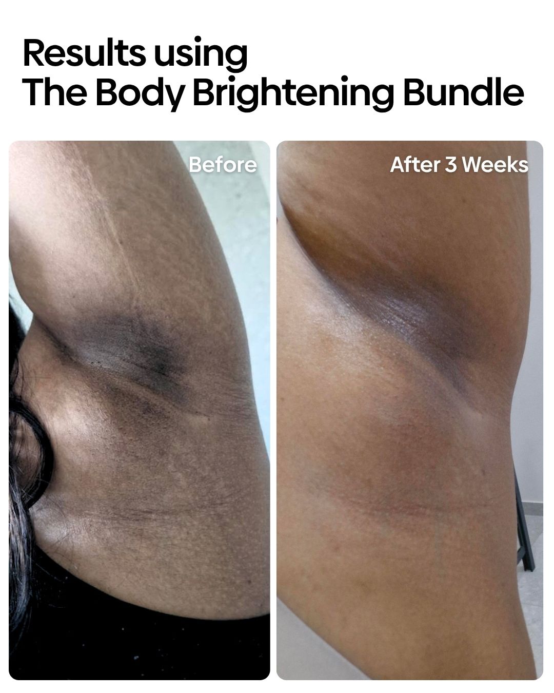 Body Brightening Bundle