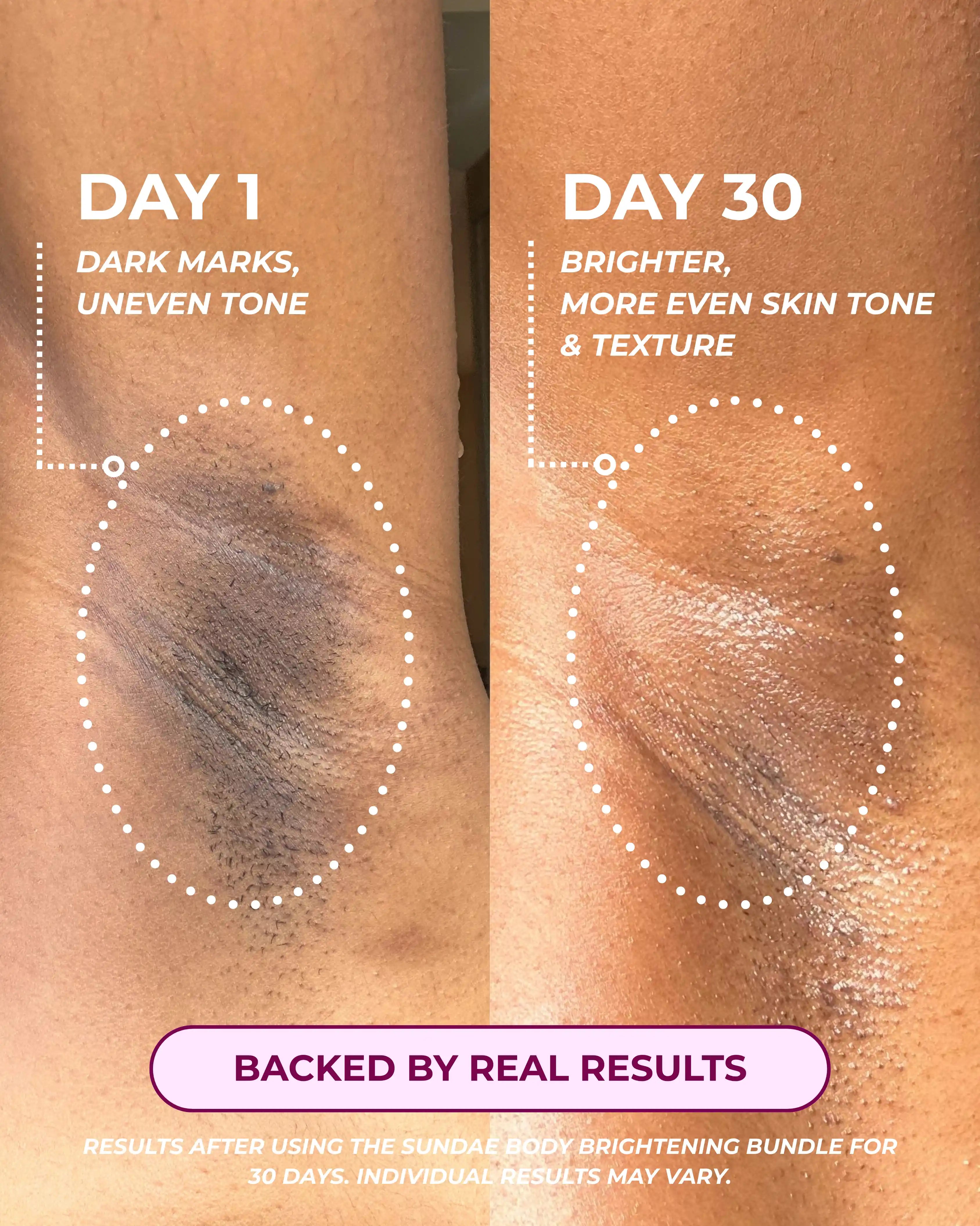 Body Brightening Bundle