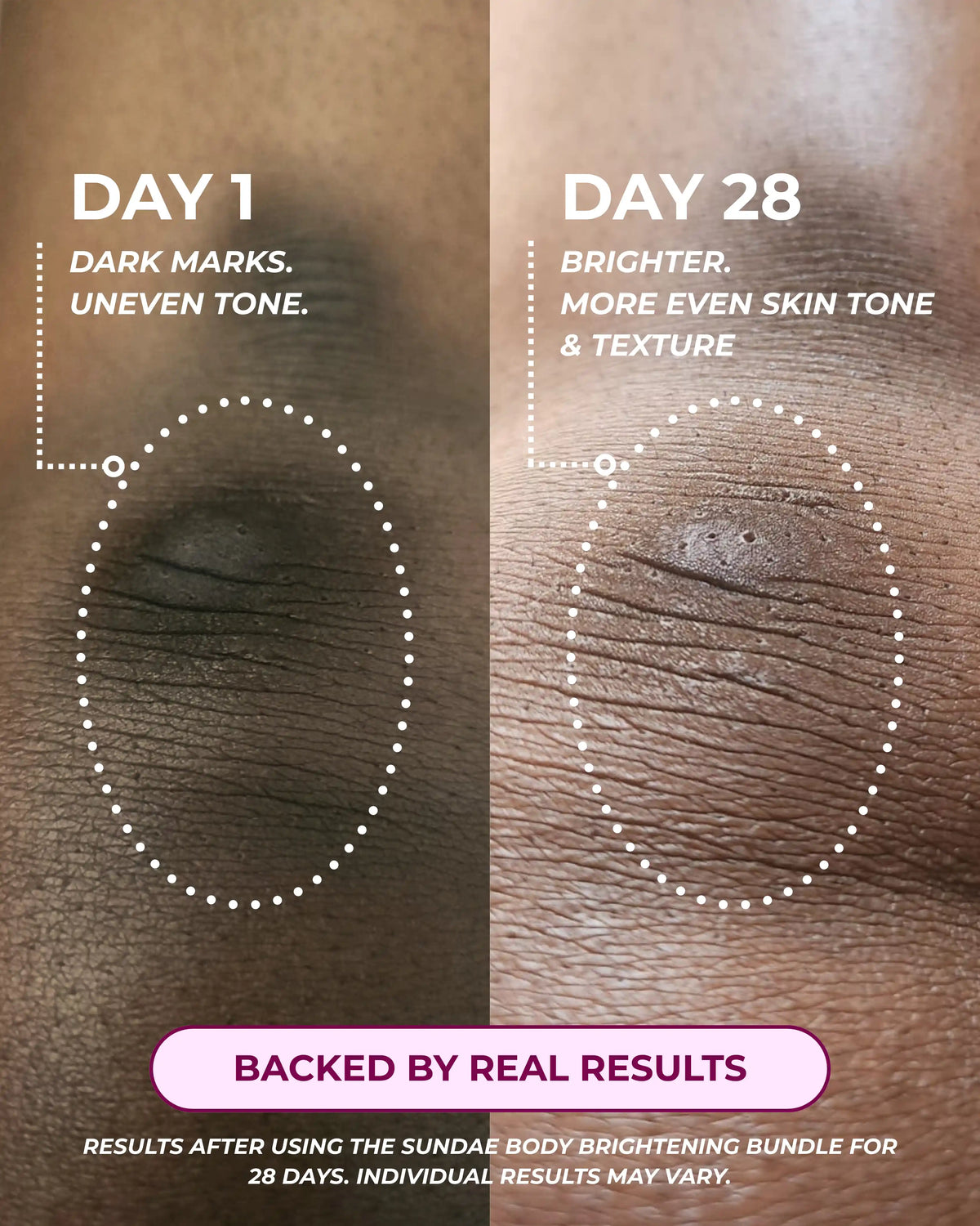 Body Brightening Bundle