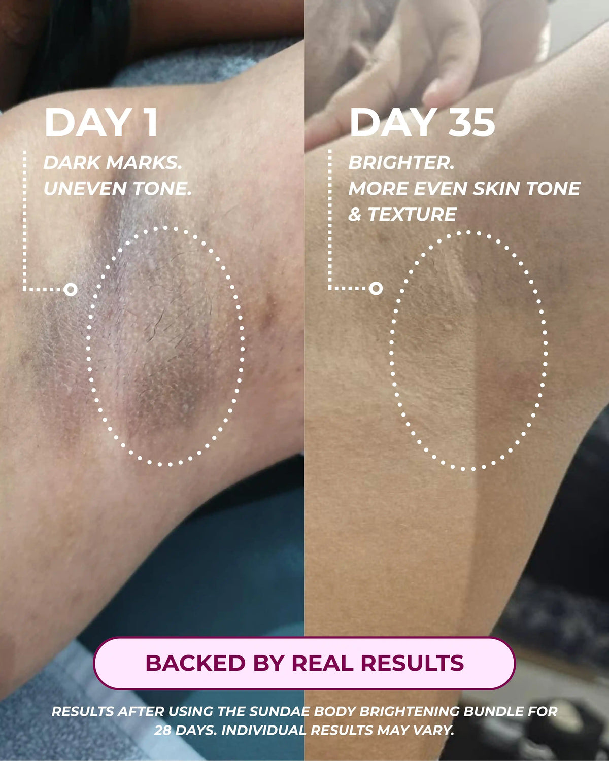 Body Brightening Bundle