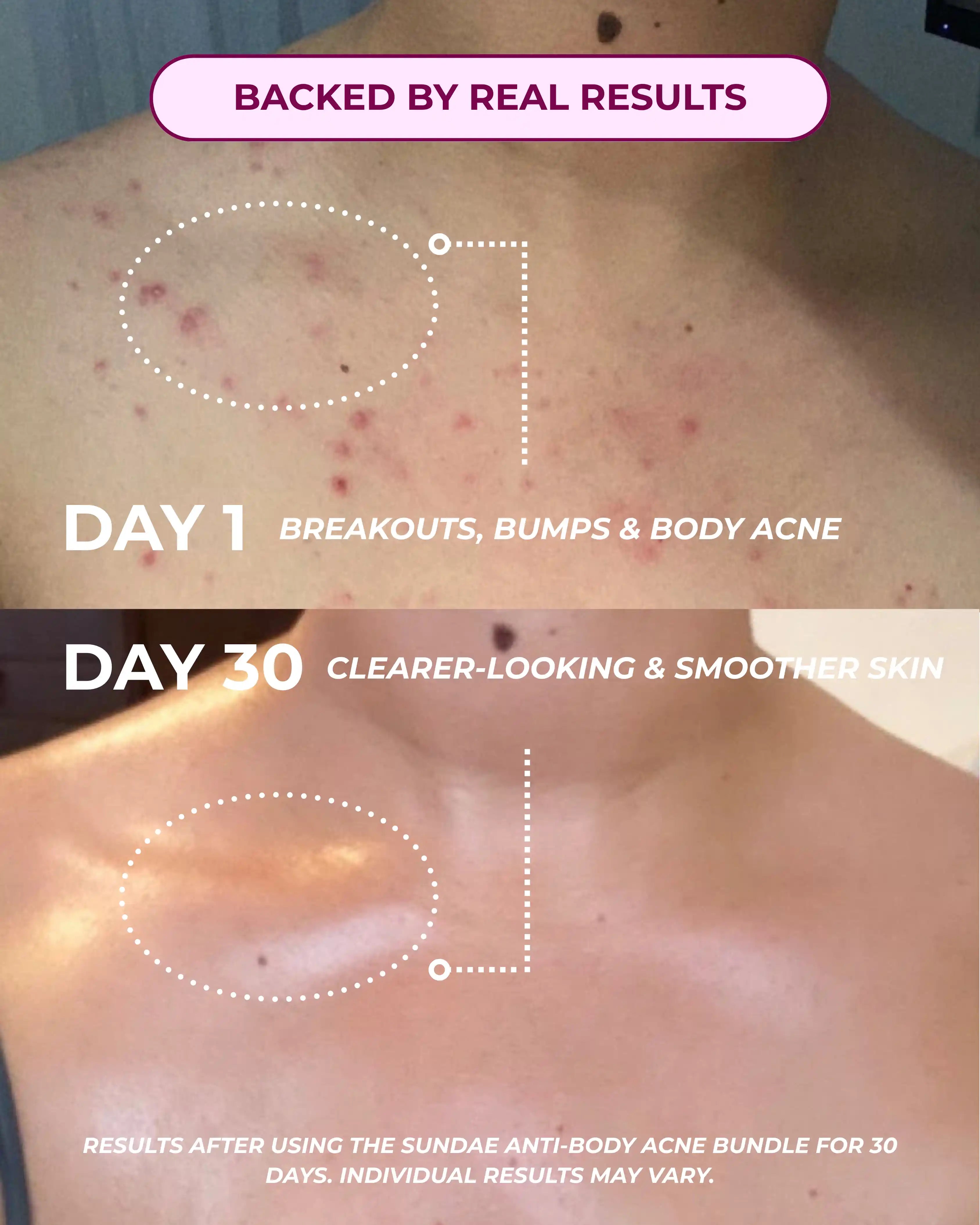 Clear Skin Check