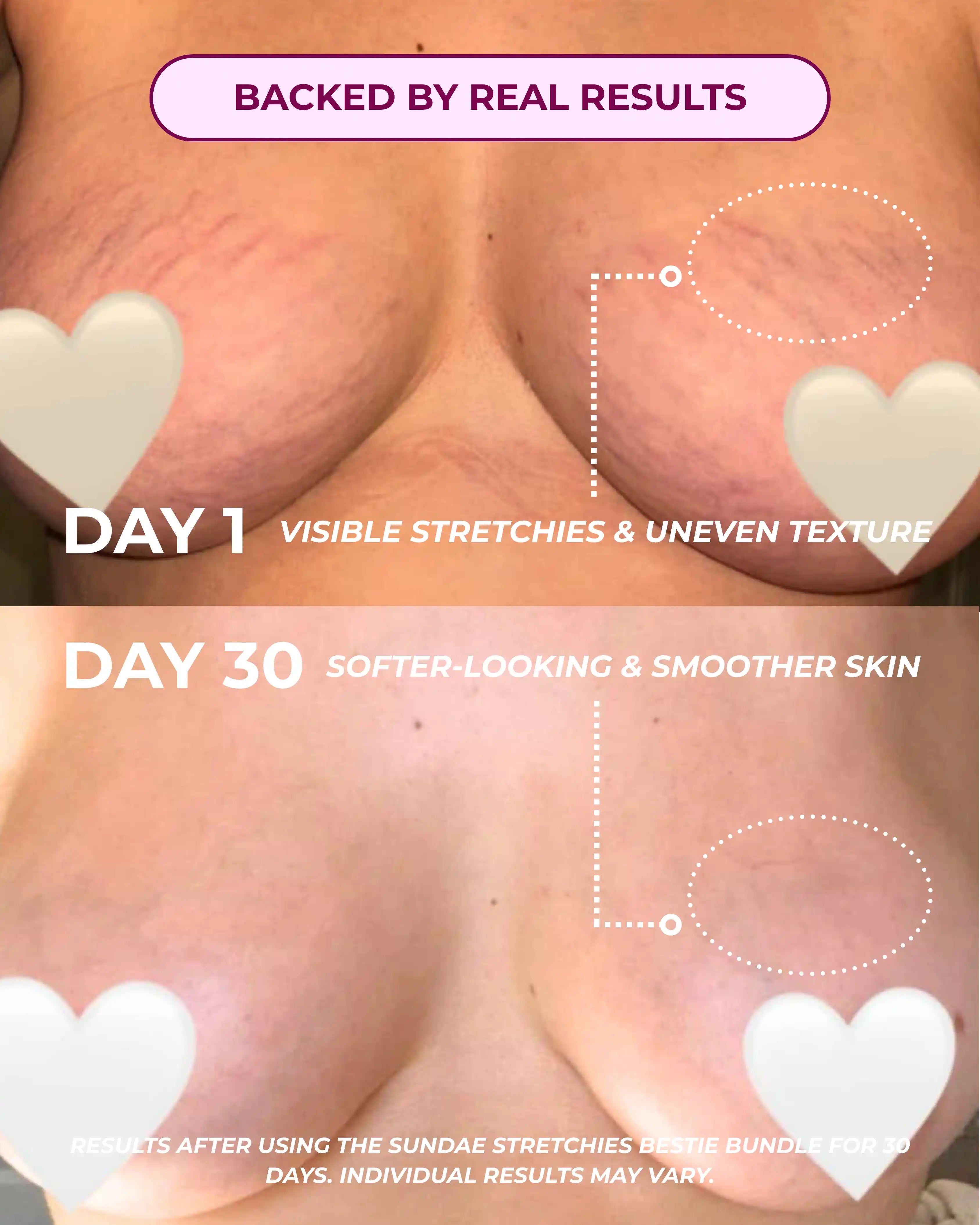 Stretchies Bestie Bundle