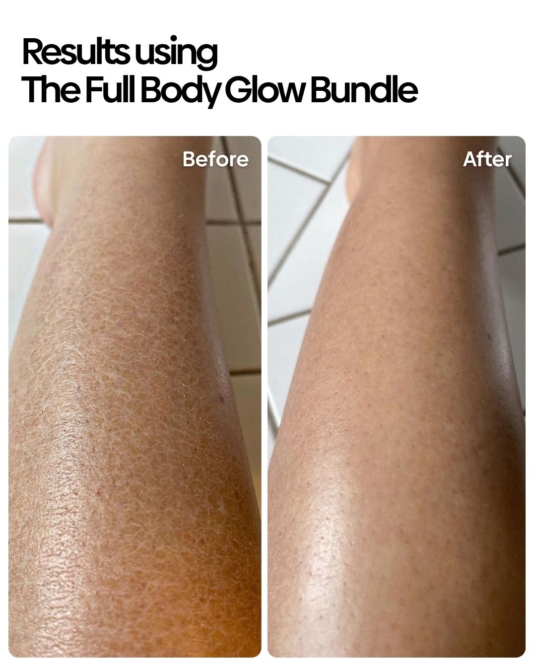 Full Body Glow Bundle