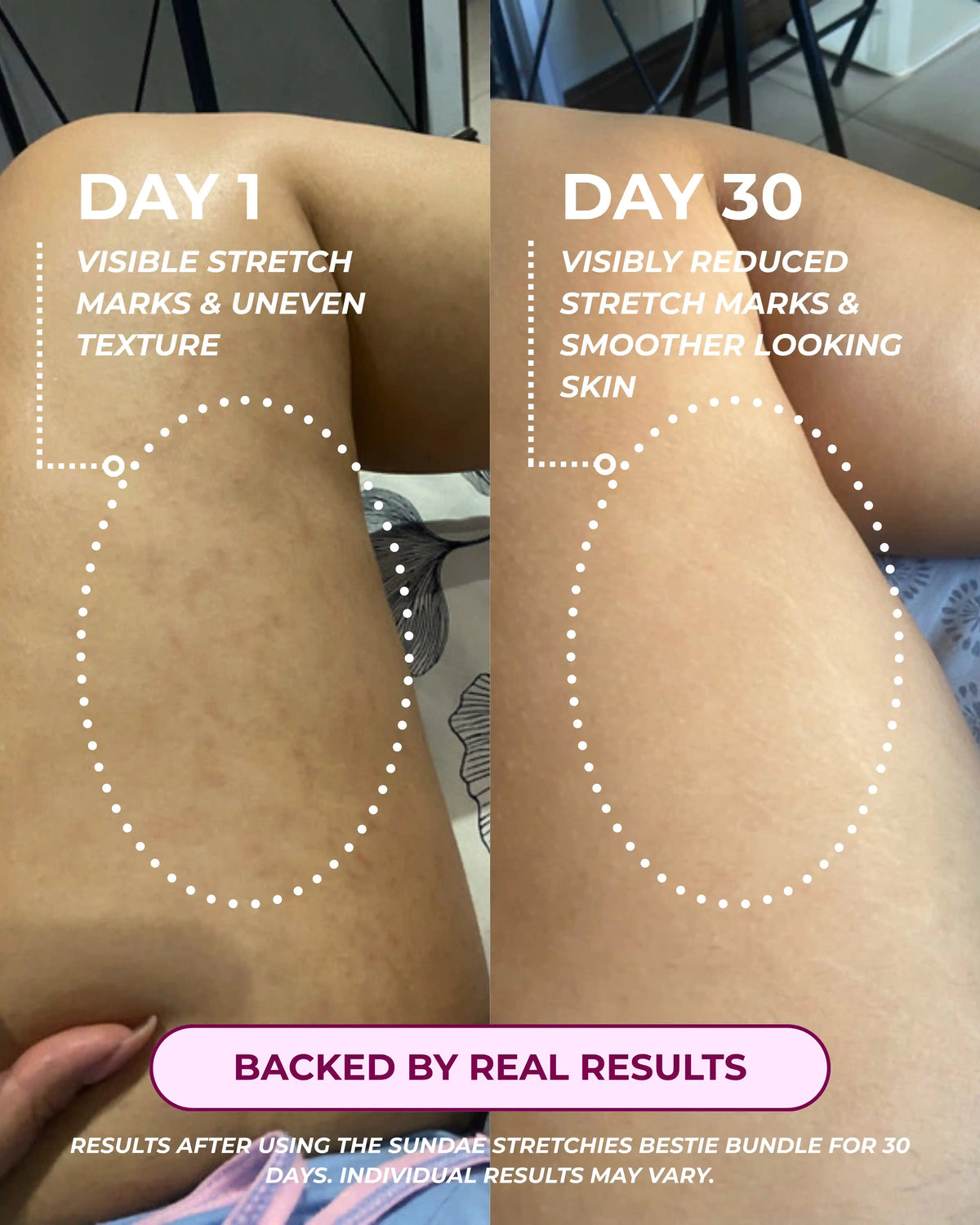 Stretchies Bestie Bundle