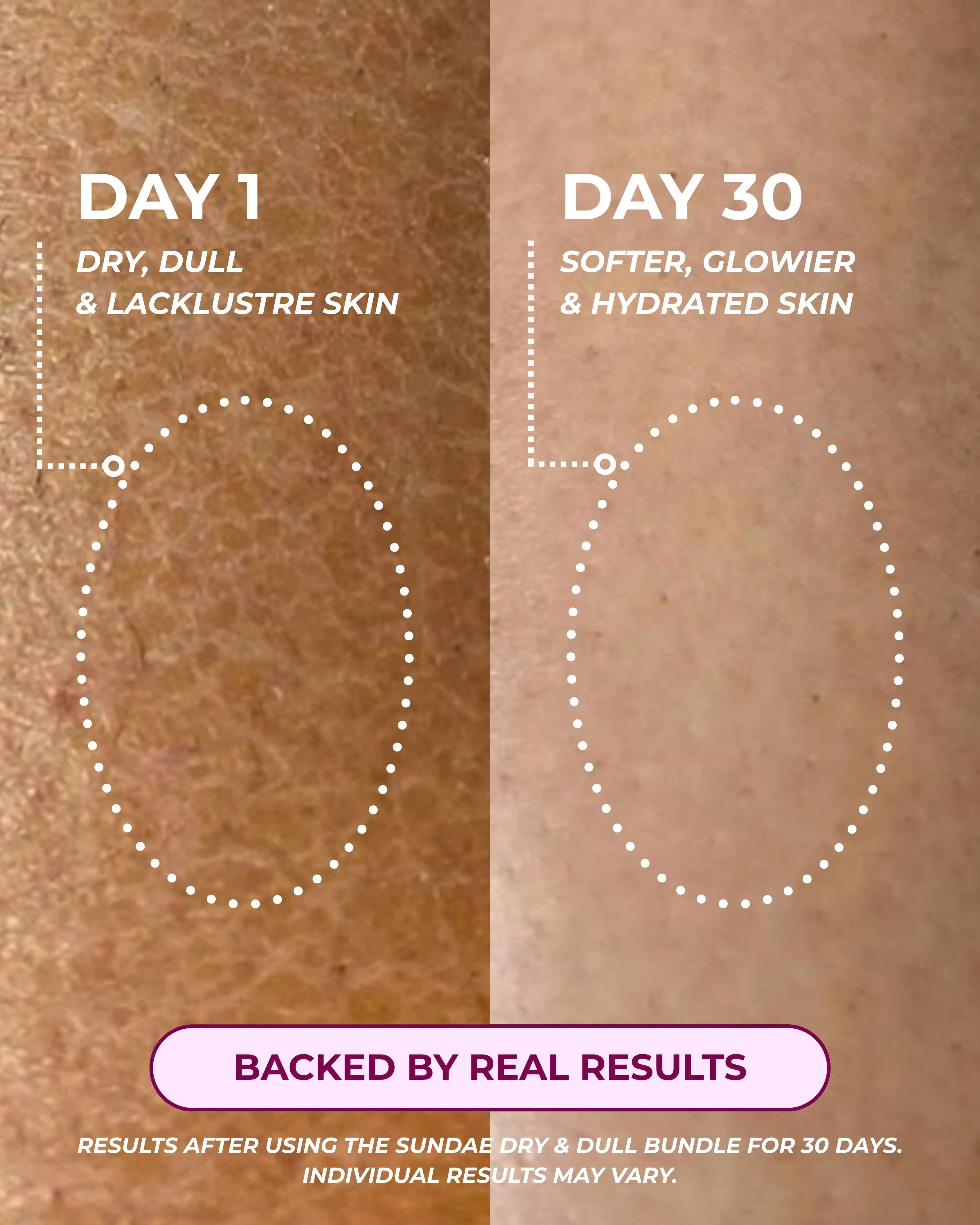 Dry & Dull Bundle